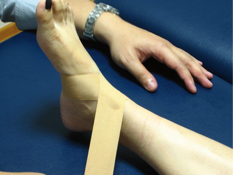 Sports Taping – Ankle